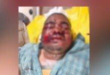 పుంగనూరు: రోడ్డు ప్రమాదంలో ఒకరికి తీవ్ర గాయాలు