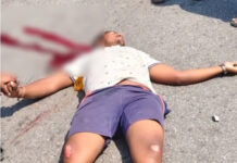 పుంగునూరు: ఫిట్స్ రావడంతో వ్యక్తికి తీవ్ర గాయాలు