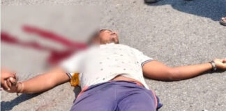 పుంగునూరు: ఫిట్స్ రావడంతో వ్యక్తికి తీవ్ర గాయాలు