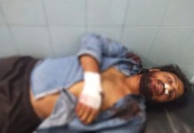 బసినికొండ వద్ద రోడ్డు ప్రమాదం – యువకుడికి తీవ్ర గాయాలు.