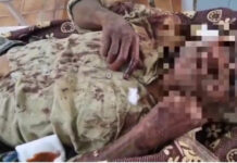 డాక్టర్ ట్రాలీ నుంచి పడి కూలికి తీవ్రగాయాలు.