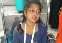 పీటీఎం: మిద్దెపై నుంచి జారిపడి బాలికకు తీవ్ర గాయాలు.