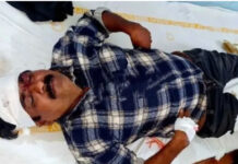 కురబలకోటలో కారు ఢీకొని భవన కార్మికుడికి తీవ్ర గాయాలు.
