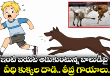 ఊర కుక్క దాడిలో బాలుడికి తీవ్ర గాయాలు.|