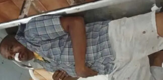 బైక్కు కుక్క అడ్డు రావడంతో దంపతులకు తీవ్ర గాయాలు.