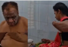 మదనపల్లెలో గ్యాస్ సిలిండర్ మంటలు.. ఇద్దరికి గాయాలు.|