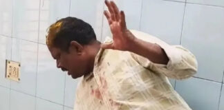 మదనపల్లెలో టైలర్ పై మందుబాబుల దాడి.