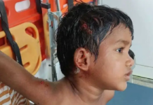 వంగరలో వీధి కుక్క దాడి బాలుడికి గాయాలు