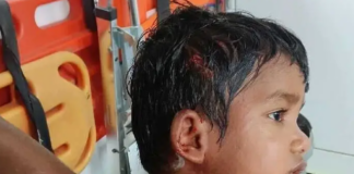 వంగరలో వీధి కుక్క దాడి బాలుడికి గాయాలు